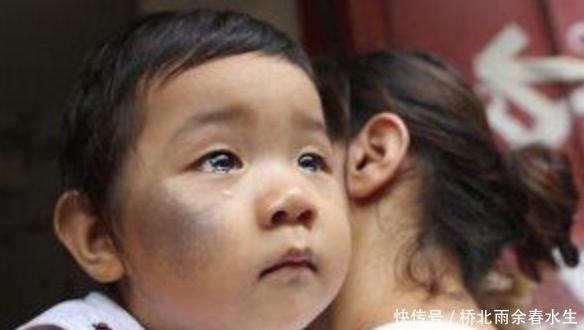 小美担心|新生儿脸上有胎记,询问医生后找到原因,这3种行为孕期别再做!