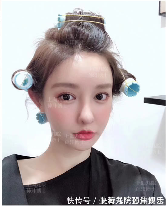 重睑线 眼修复孙沣博士:双眼皮术后是否会产生疤痕和增生?