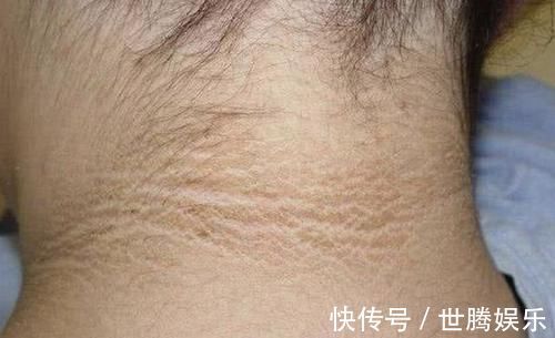 生活水平|6岁女儿脖颈发黑洗不掉,送医院检查,医生的解释令宝妈哭笑不得