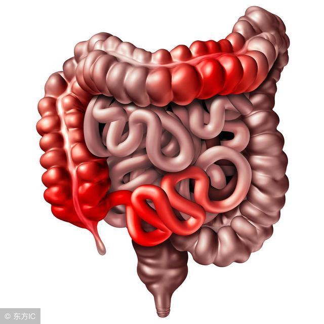 食物|无论男女,5种食物吃下肚,便秘来,肠道堵得“水泄不通”