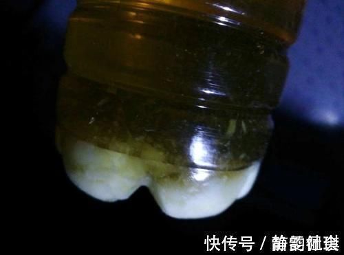 患上糖尿病|糖尿病,会出现“1降1白3多”的提示,做好3件事,血糖慢慢降