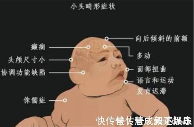 男子|非洲一男子长相似猴子,不吃饭只吃香蕉,常被人当动物欺负