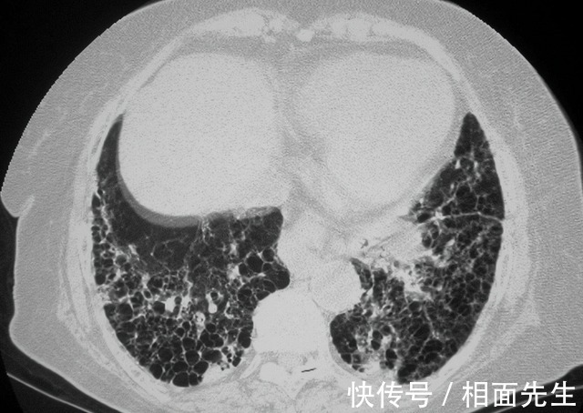 感冒药|恶毒至极!18岁女孩“遭姐夫”下毒:将“百草枯”掺进感冒药中!