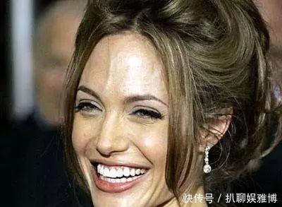 往提示|人体“青筋”凸起,反应身体的健康情况,越早看越好!