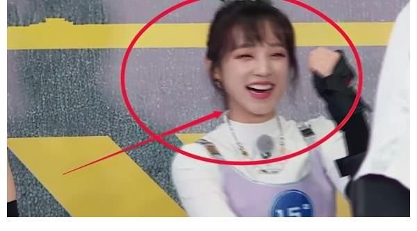 被大球砸到牙疼，宋雨琦卻慌張撫摸下巴，看清下巴形狀我明白了