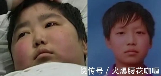 骨髓|生下来嫌弃是女孩就送人,15年后儿子患病让捐骨髓,女儿:我不捐