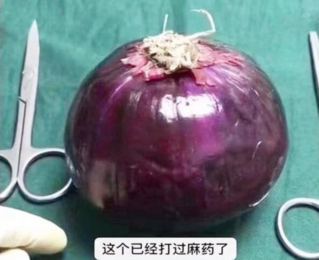 麻醉针|选剖腹产不疼这根10厘米的麻醉针仅仅是开始,疼到你怀疑人生