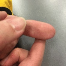 气血不足|气血足不足,就看这4处!老中医2妙招,教你快速把气血补起来!