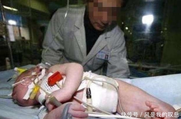 怀胎|22岁女子十月怀胎却生下一条“美人鱼”，医生讲出原因后情绪失控