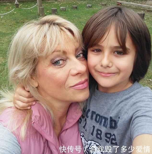 54岁女子贪图便宜,花费2万元在黑市整容,整容后年轻了20岁