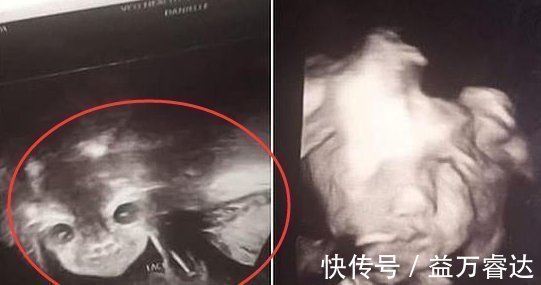 宝宝|孕24周B超检查,当看到宝宝的样子后,孕妈有些吓到了