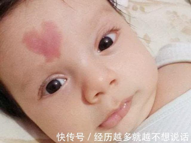 维产科专家要想宝宝不长胎记,孕期避开三件事就OK,别不当回事