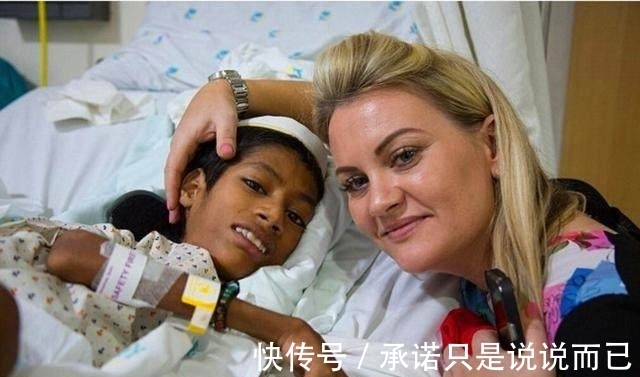 利瓦|男孩头部怪异,只能挂在胸前,手术7个月后的模样让人感动到哭!