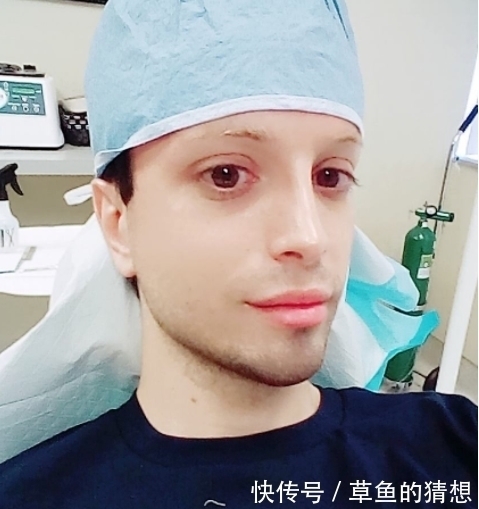 手术|男子花23万削尖耳朵漂白皮肤,每月花3万护理只为成现实中精灵