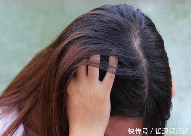 头皮上有白色的东西，很多人都喜欢抠，这些到底是什么东西？