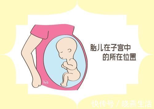 准妈妈|孕妈肚子的形状，和胎儿性别有关？孕产专家告诉你答案