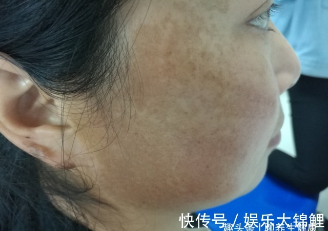 营养物质|医生提醒：女人更年期后，少吃这3样食物，或能远离“黄脸婆”