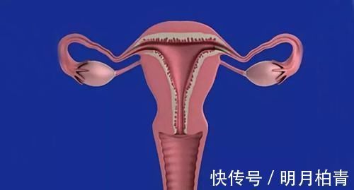 子宫肌瘤|女性有子宫肌瘤?别怕,常吃这6种食物,肌瘤或将慢慢消失