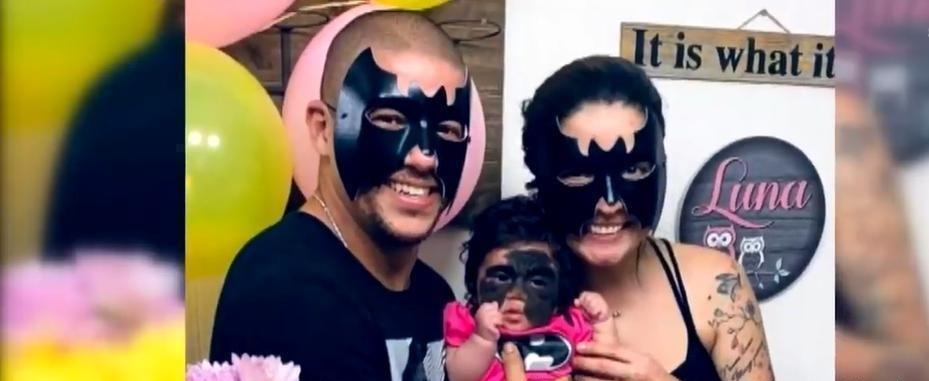 孕期|那个脸上有“蝙蝠”胎记的女孩,如今生活的怎么样?看完很欣慰