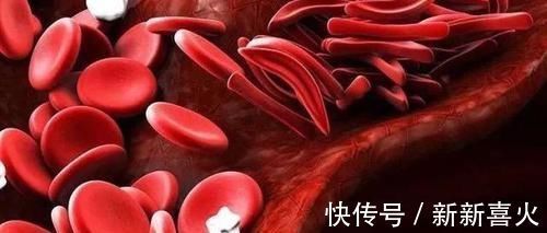 桃子|“血栓克星”被发现,每周吃一吃,常做3事,血管通畅,一生无栓