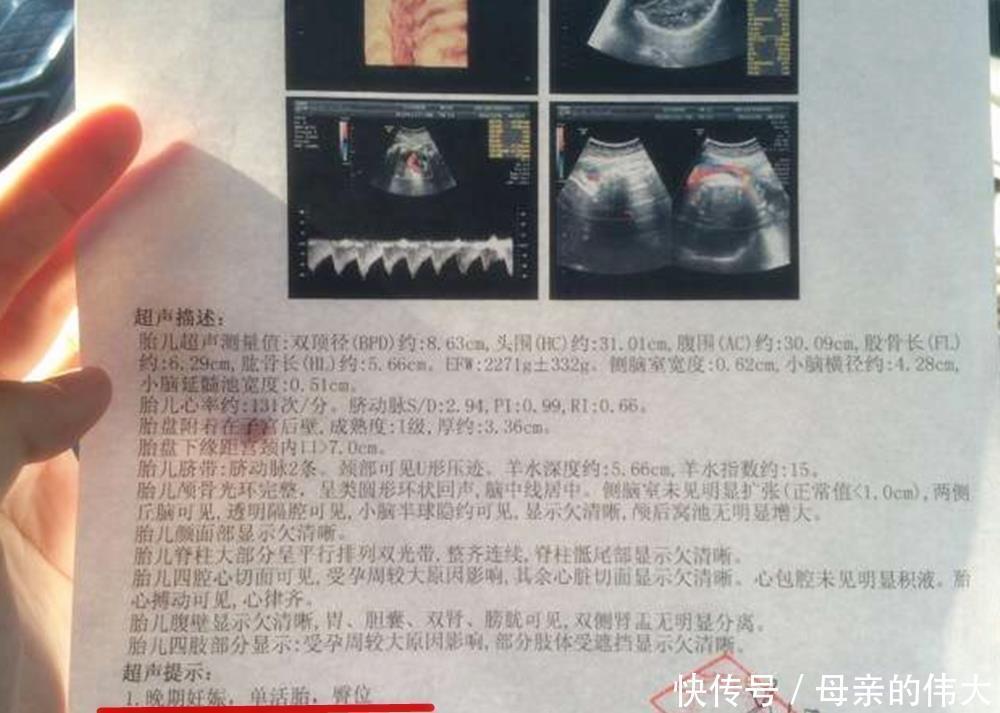 宝宝|怀孕后多久,胎位就要固定了?这个孕周前,孕妈还能“调乾坤”