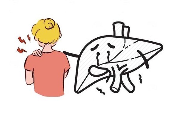 关节|肩痛可能是肝癌前兆?一文教你区分“肩周炎”和“癌痛”,别搞混