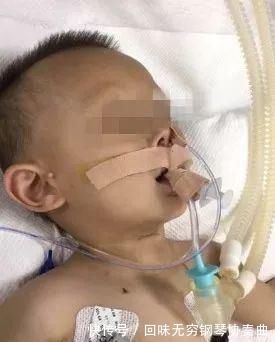 意外伤害|一个炒菜的功夫孩子就没了医生泣血忠告这些底线千万不要让孩子碰