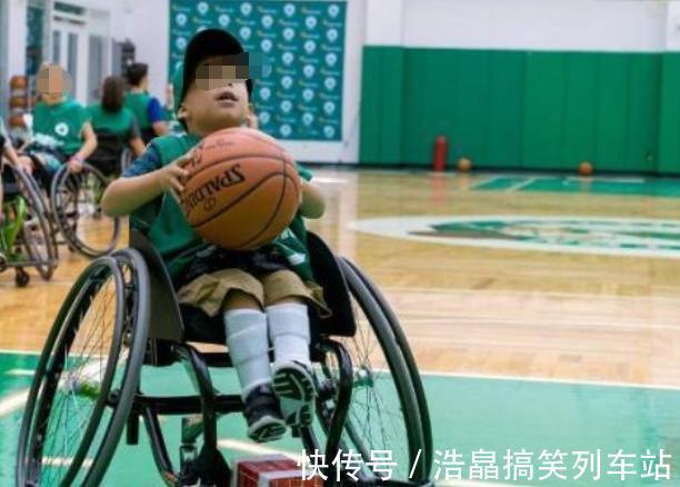 双胞胎|双胞胎被查出“畸形”,准妈妈不顾劝阻坚持生下,是自私还是母爱