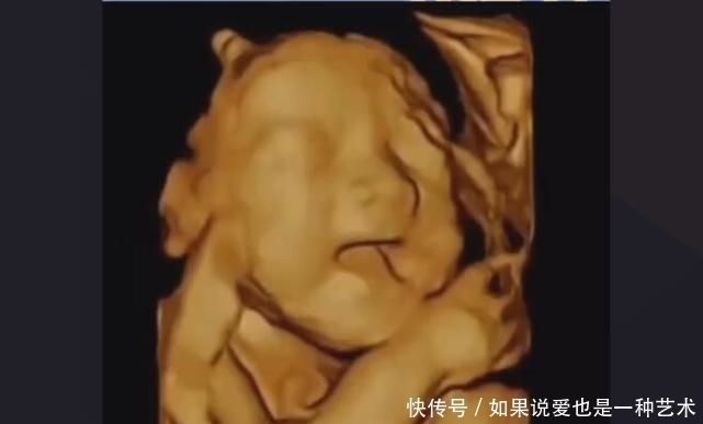 判断|怀孕晚期,如何判断“要生了”?3个方法要牢记,别把孩子生家里