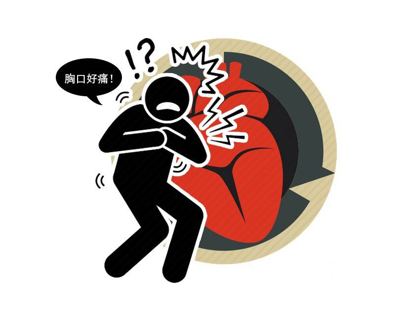 心绞痛|长期放纵释压,男子差点死在心梗?做好5件事,别给自己留下遗憾