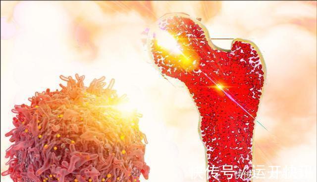 骨质|骨疏松是因水煮蛋吃多了?骨科:想要骨头好,3种食物也尽量少吃