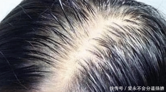 伤害|新闻曝光洗发水黑名单,许多知名品牌中枪,消费者表示受到了伤害