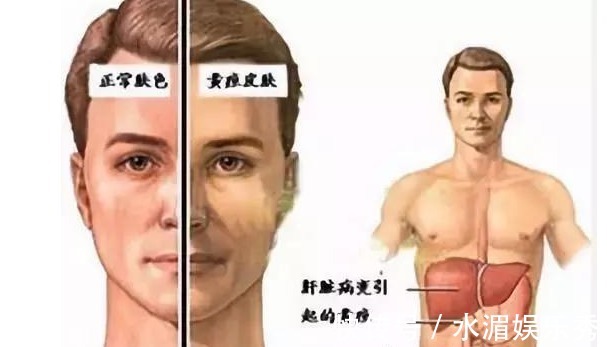 信号|大病来临前的10个信号,需要时刻注意,健康常识!