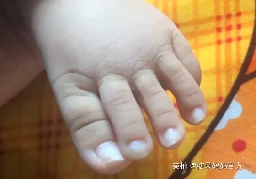 脚趾长|宝宝脚趾赛手指,妈妈伸出脚大家又沸腾了,网友长大得长多高