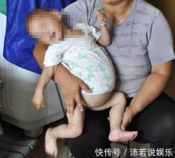 橙橙|宝宝肚子差点胀破!医生查出肚里东西,爸爸妈妈看后吓蒙!