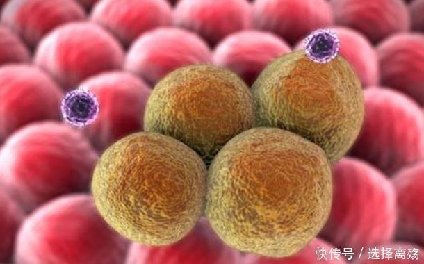 人体|为什么癌症早期都不痛不痒、毫无症状看完受益终身