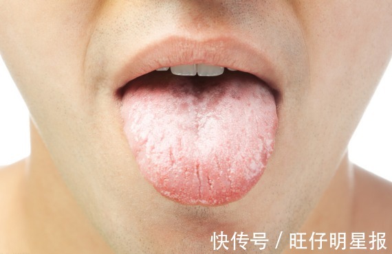 血脂|高血脂的“祸根”不止是油，经常吃这3物，血脂会黏如“粥”