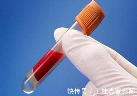 食用油|你害怕癌症找上门,癌症其实也会怕你,就怕你经常做这8件事