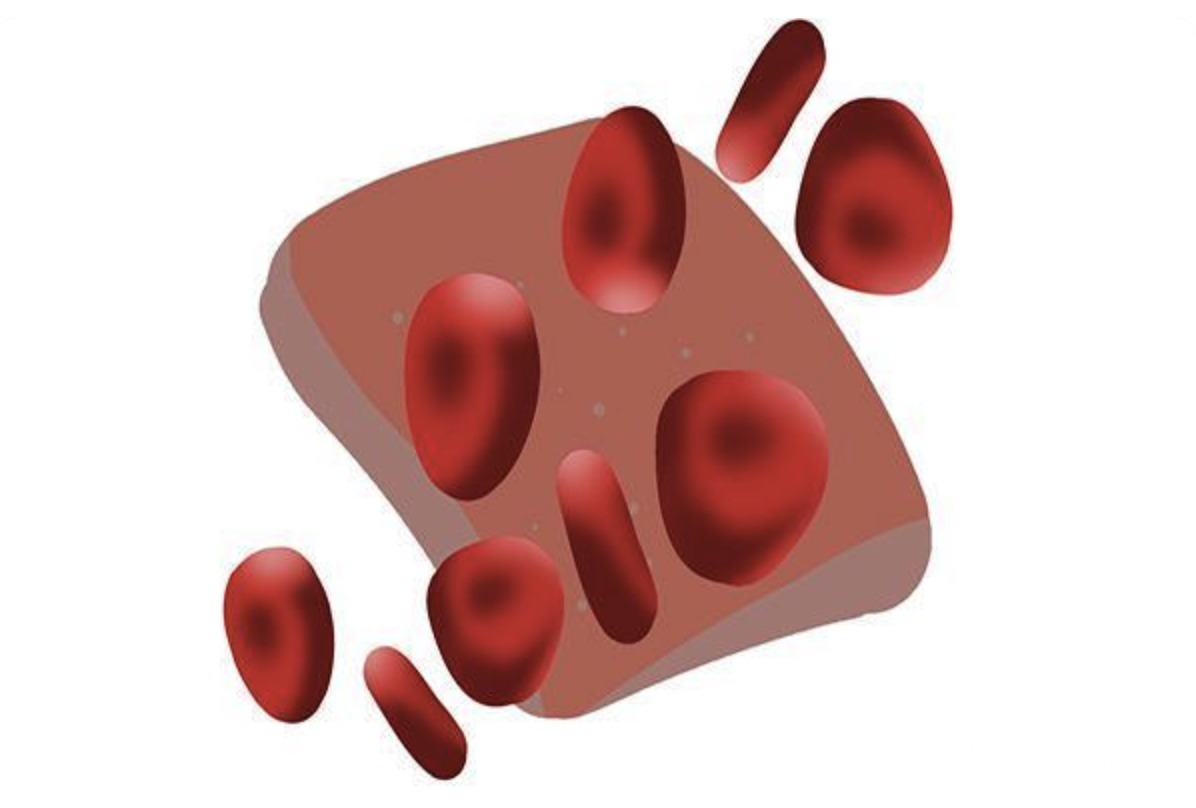 血脂|高血脂的“死对头”并不是肉，若再不忌口，血脂或会“只升不降”