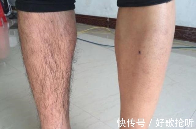 宝妈|为什么有的男生腿毛浓密，而有的男生却是“光秃秃”的？涨见识了