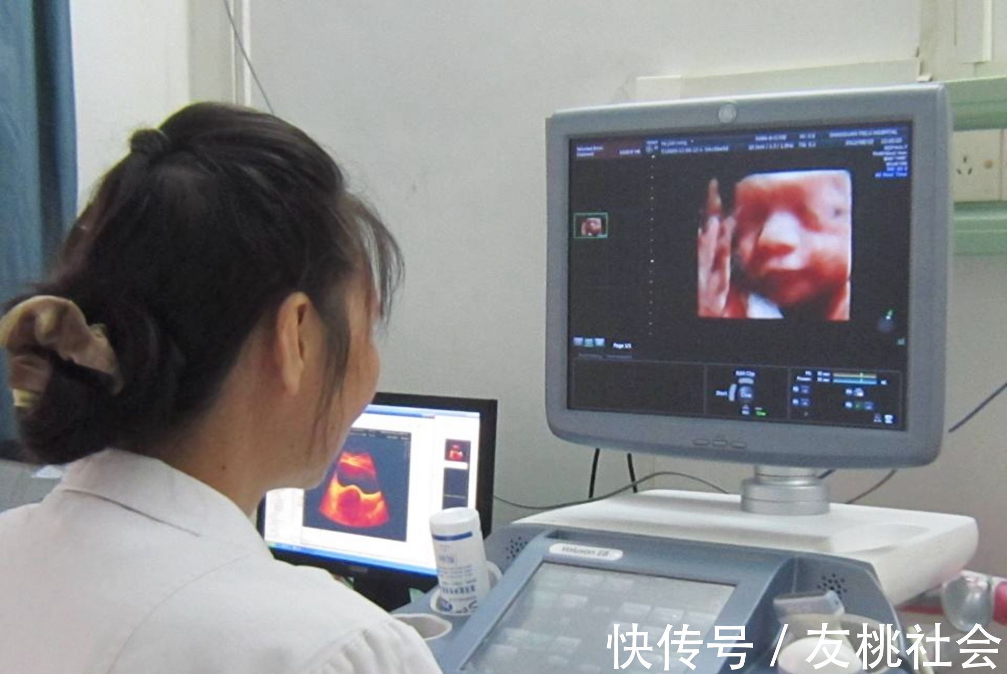 孕妈|产检做四维彩超,为什么“家属勿入”?其实是出于“三保护”原则