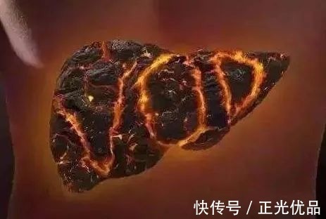 去火穴|口干舌燥,口臭眼干怎么办?人体三大“去火穴”,秋季降肝火看这