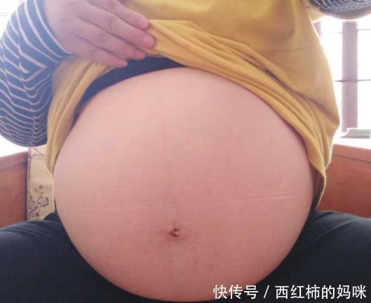 形体|为何孕晚期会诊断畸形?过四维彩超,准妈妈也不能大意