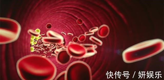 饱和脂肪酸|血脂高了怎么办医生提醒8种方式,10个饮食原则,远离高血脂