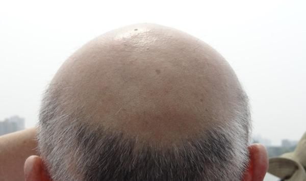 肾功能|三个表现一出现，说明男人已经开始步入衰老了，再嘴硬也没有用