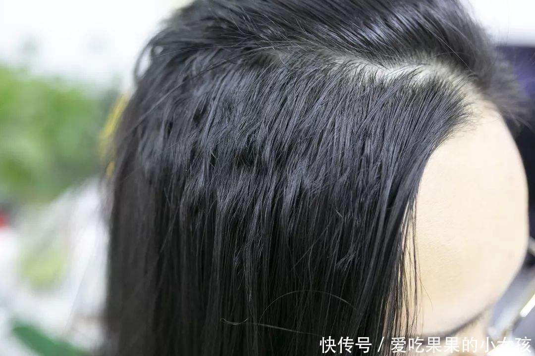元素|掉发、发质干枯、头发长得慢专家很可能是身体缺乏这些元素