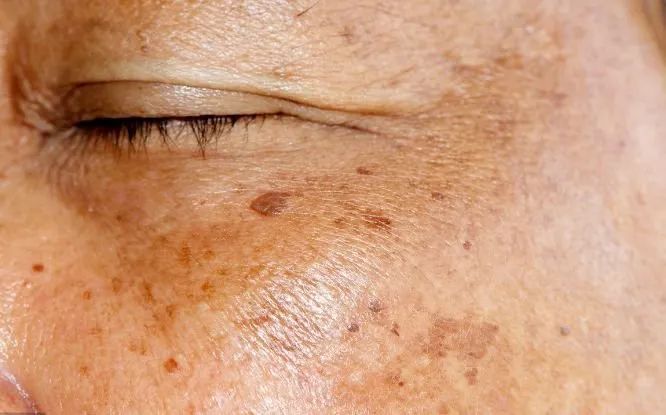 肝脏|肝部变脏，会出现4个异常，坚持“七个一”，给肝洗洗澡，排排毒