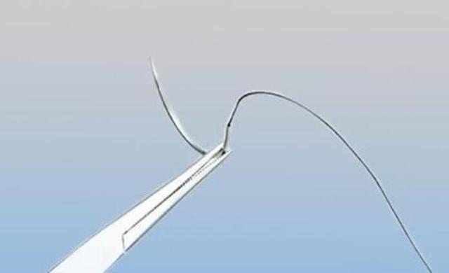 疤痕|为啥现在的剖腹产都不用“拆线”不“拆线”的利弊,孕妇要清楚