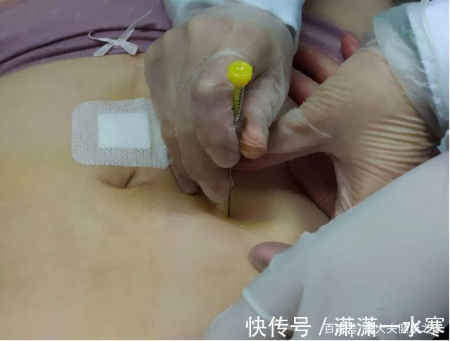 高血脂|降脂必看，得了高血脂症和动脉粥样硬化，该怎么办