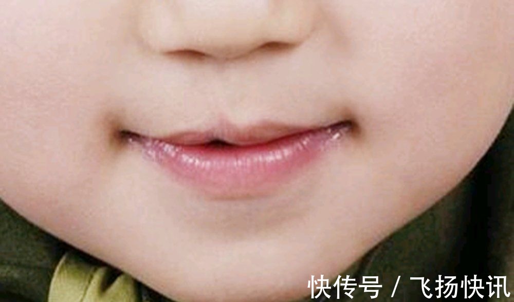 检查|为何在孕期正常吃叶酸,胎儿还会“唇腭裂”?孕妈别耍小聪明了